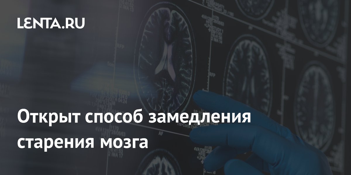 Preview Ученые обнаружили способ замедлить старение мозга, влияя на белок FTL1