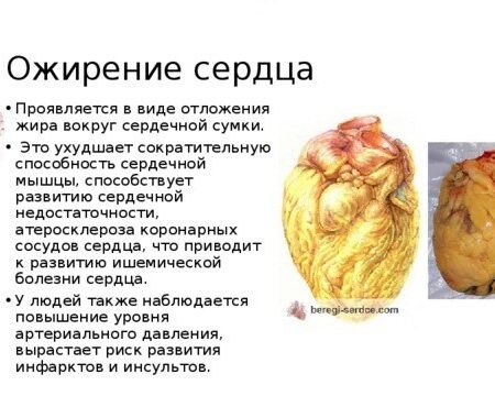 Неожиданный фактор ускоренного старения сердца: значение локализации жира
