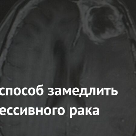 Открыт метод замедления прогрессирования агрессивного рака мозга