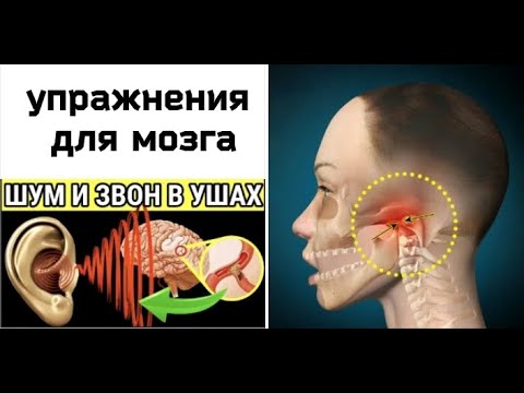 Preview Хронический шум в ушах: тревожный сигнал для здоровья мозга