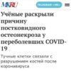 COVID-19 и риск остеонекроза: Российские ученые бьют тревогу