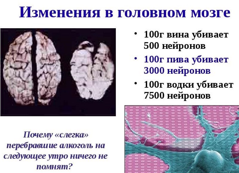 Preview Молоко яка: Защита мозга от последствий алкоголя