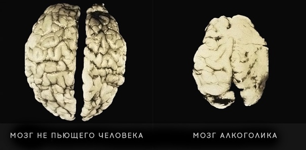 Preview Молоко яка как потенциальный защитник мозга от последствий алкоголя
