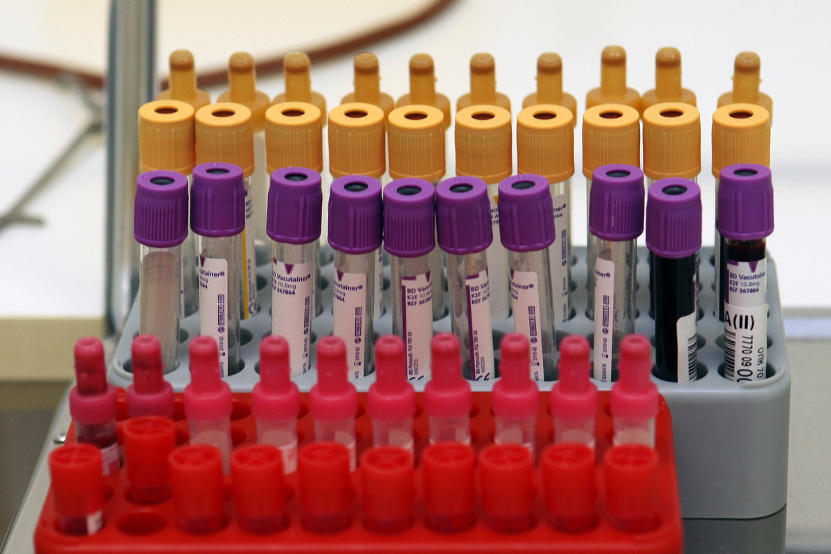 Preview Разработан первый точный анализ крови для выявления синдрома хронической усталости