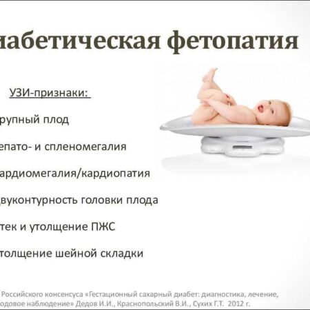 Обнаружен редкий тип диабета, поражающий младенцев